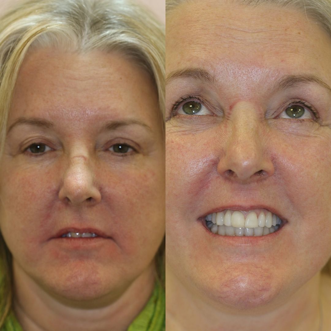 Creating New Smiles @ 740 Dental