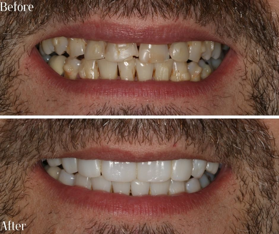 Patient Gallery - 740 Dental