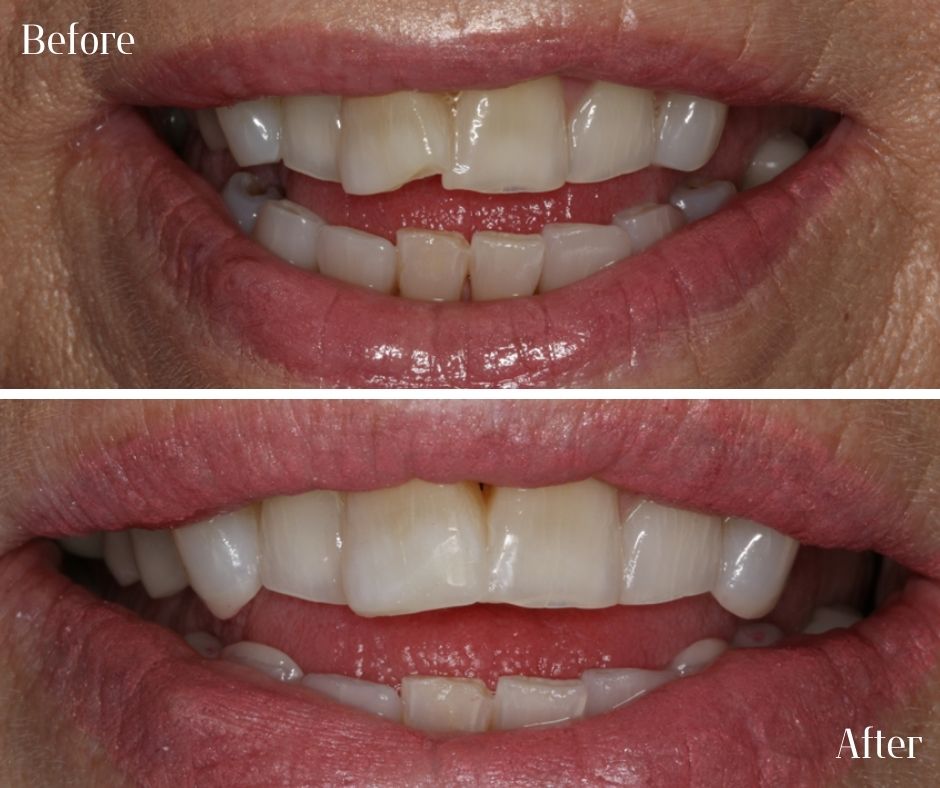 Patient Gallery - 740 Dental