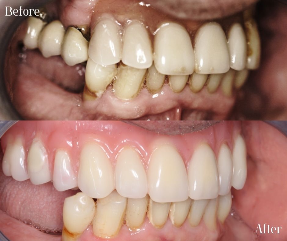 Patient Gallery - 740 Dental