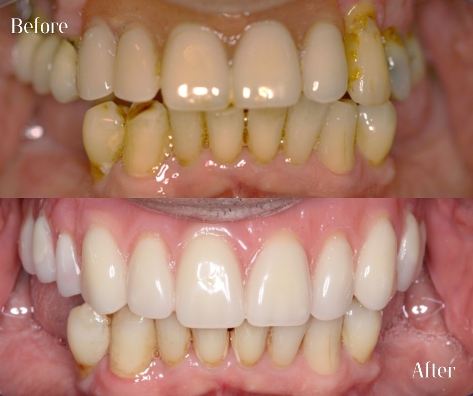 Patient Gallery - 740 Dental