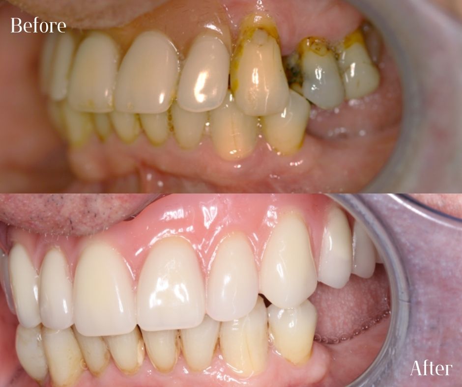 Patient Gallery - 740 Dental