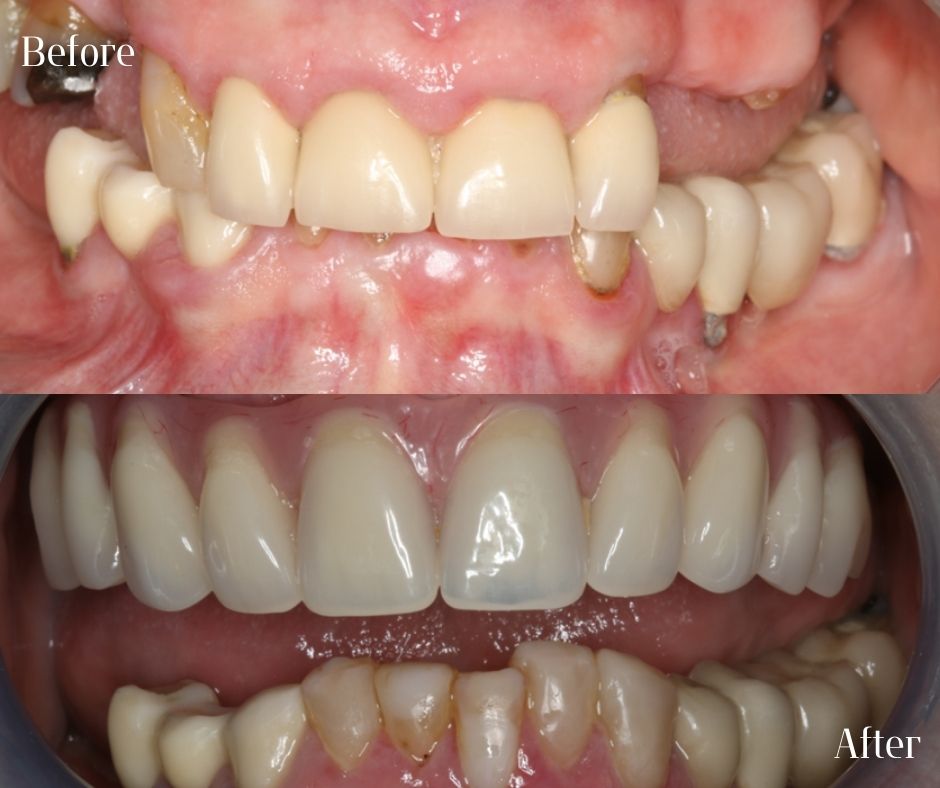 Patient Gallery - 740 Dental