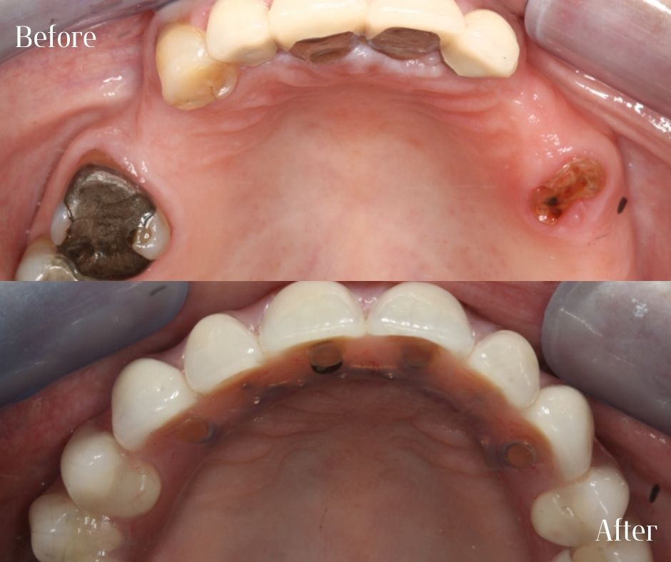 Patient Gallery - 740 Dental