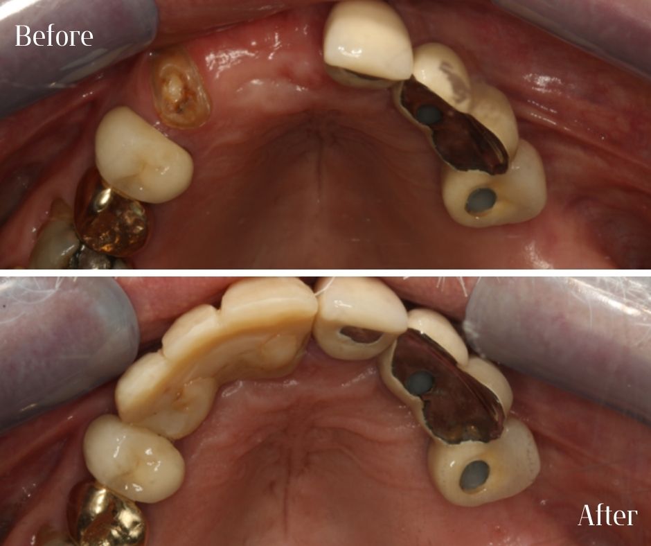 Patient Gallery - 740 Dental