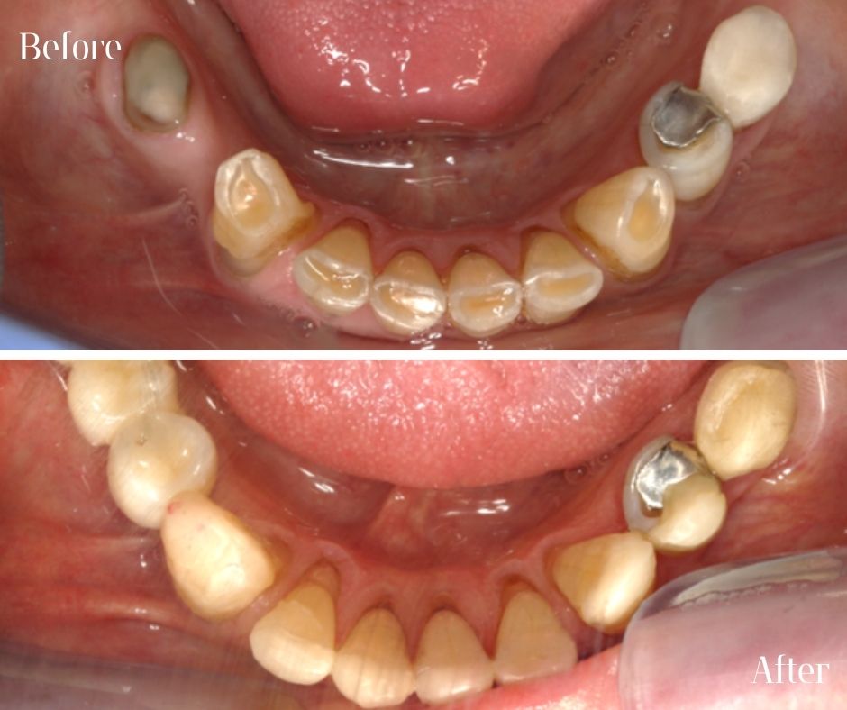Patient Gallery - 740 Dental