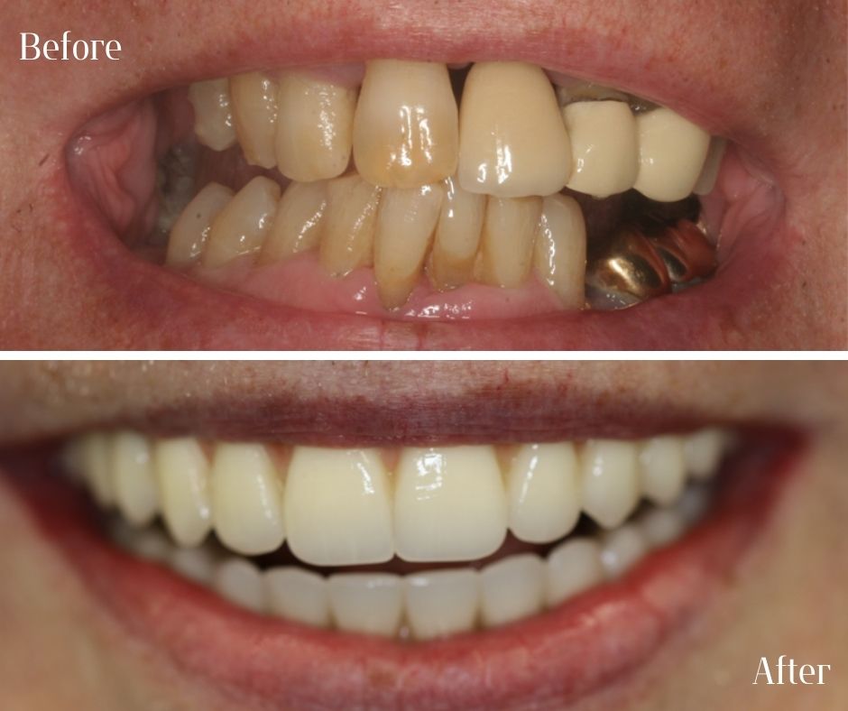 Patient Gallery - 740 Dental