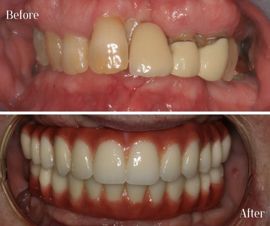 Patient Gallery - 740 Dental