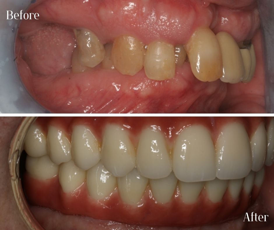Patient Gallery - 740 Dental