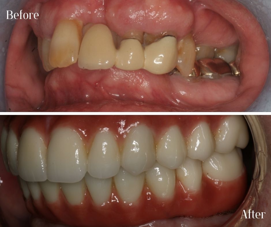 Patient Gallery - 740 Dental