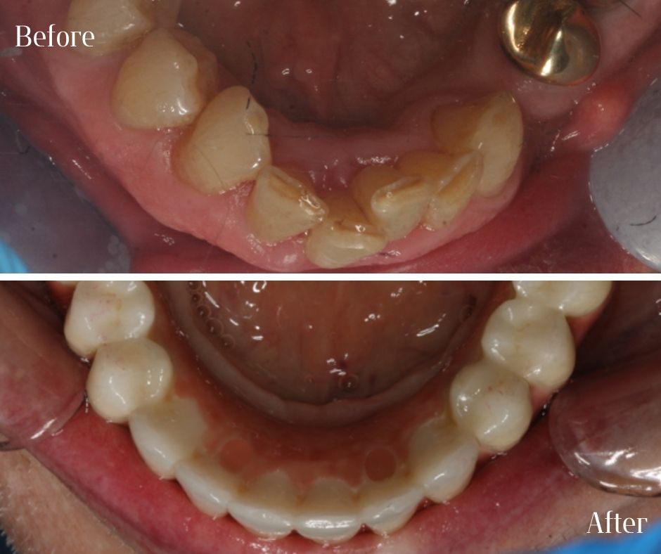 Patient Gallery - 740 Dental
