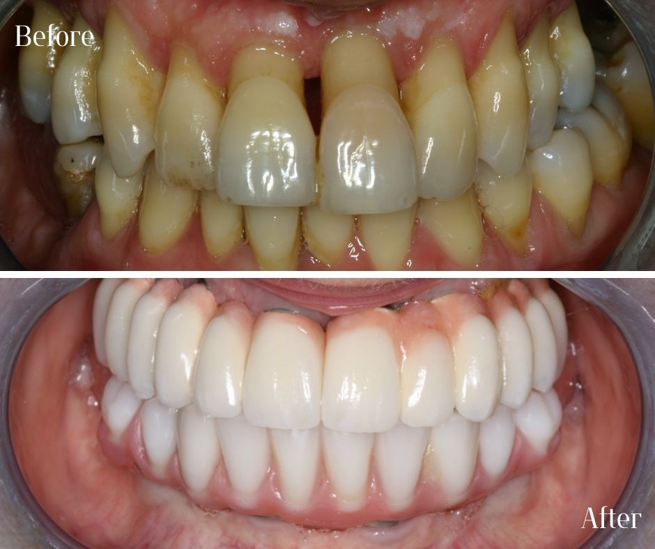 Patient Gallery - 740 Dental