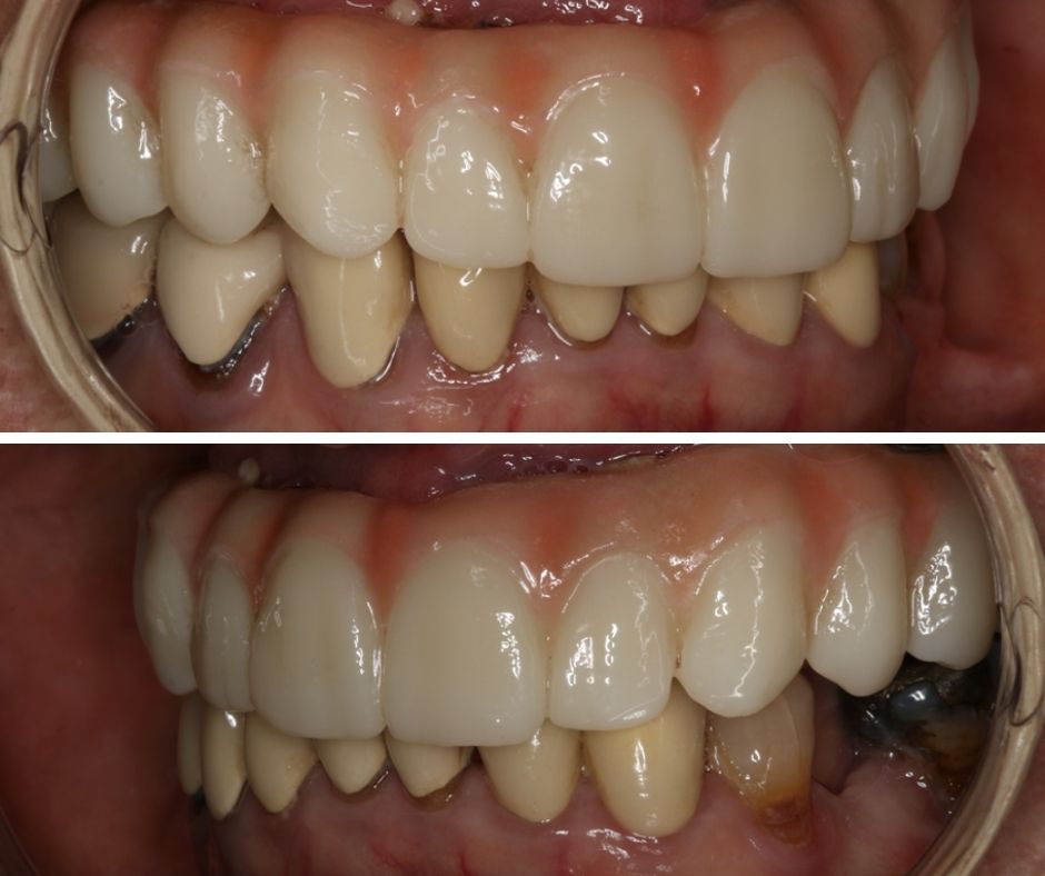 Patient Gallery - 740 Dental