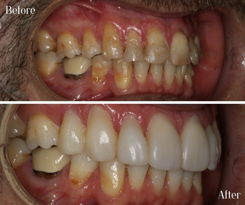 Patient Gallery - 740 Dental