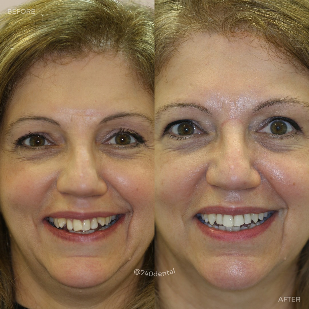 Creating New Smiles @ 740 Dental