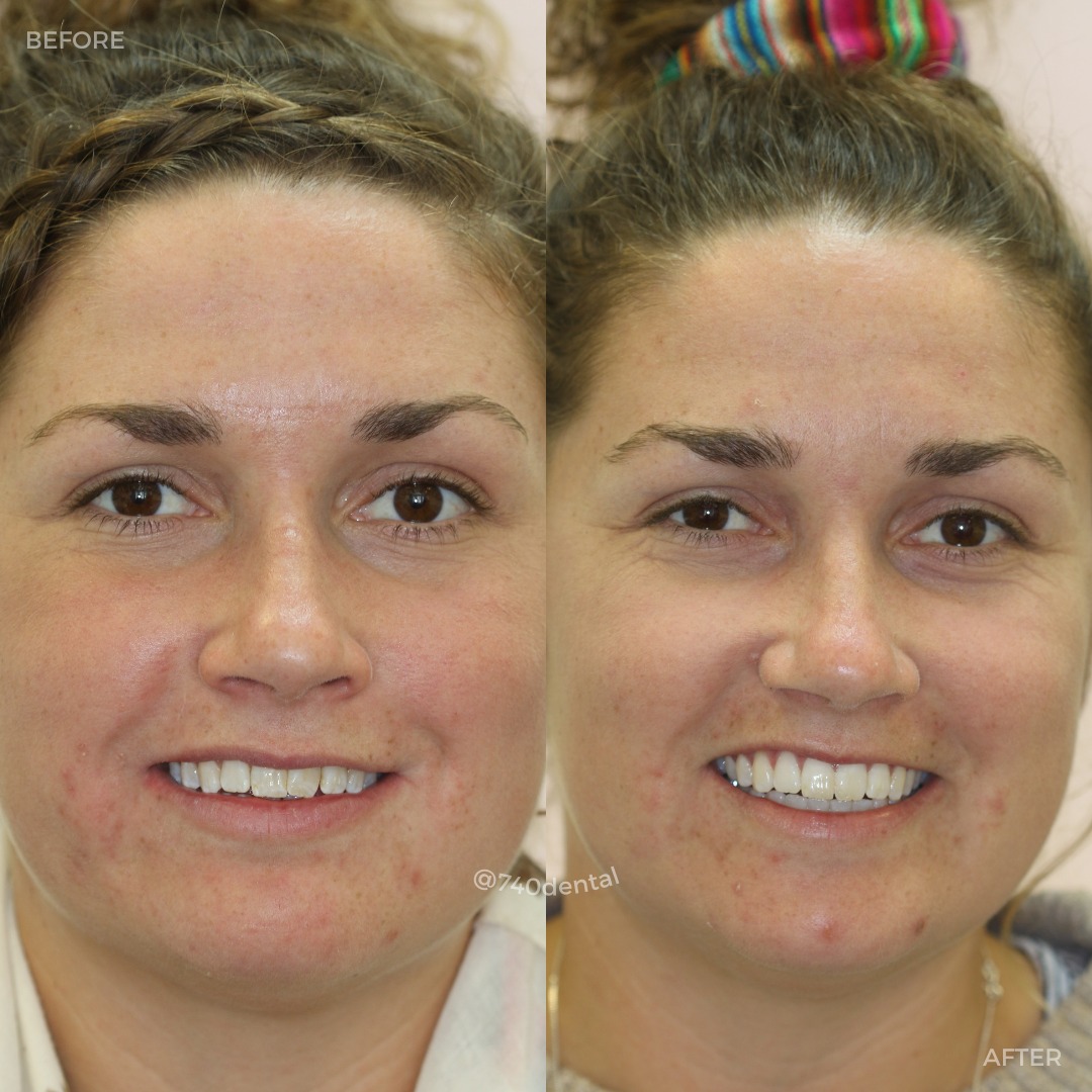 Creating New Smiles @ 740 Dental