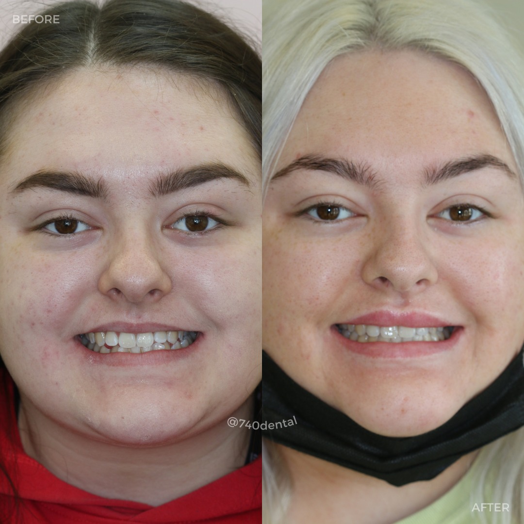 Creating New Smiles @ 740 Dental