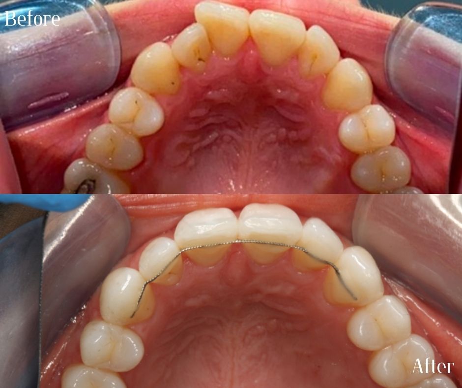 Patient Gallery - 740 Dental