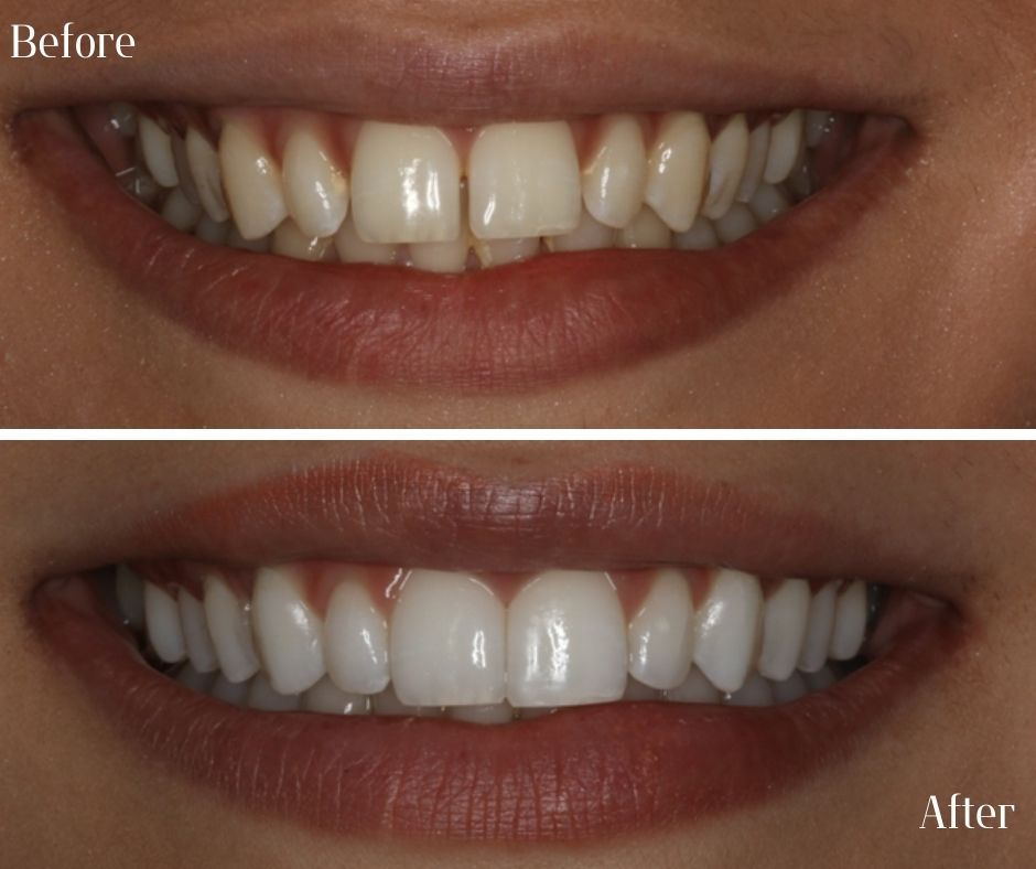 Patient Gallery - 740 Dental