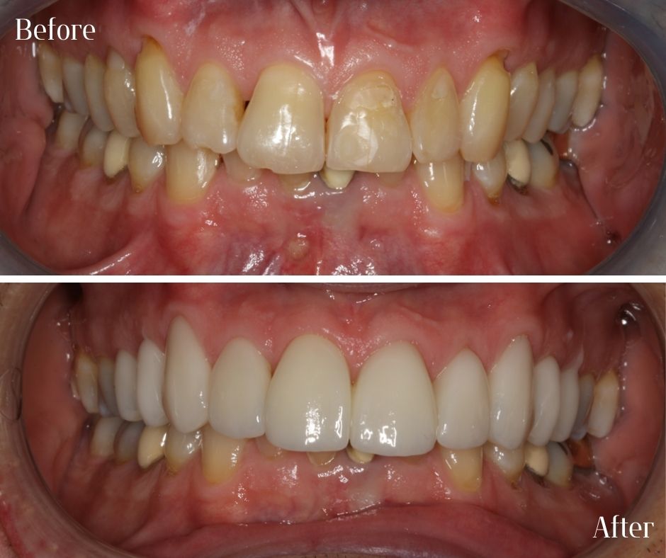 Patient Gallery - 740 Dental
