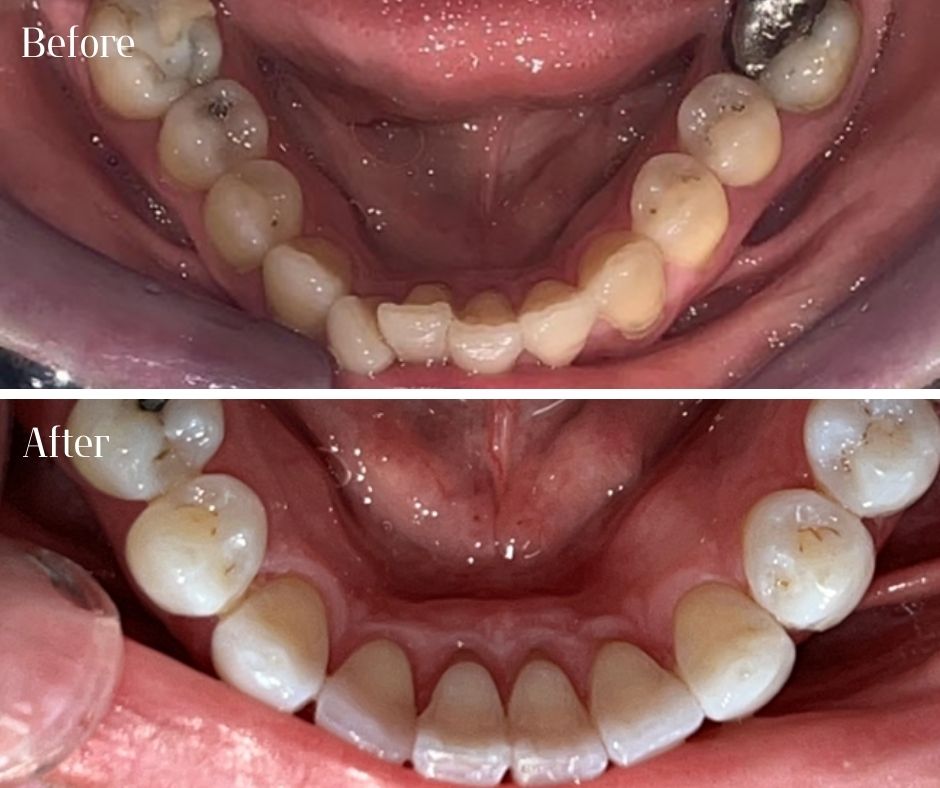 Patient Gallery - 740 Dental