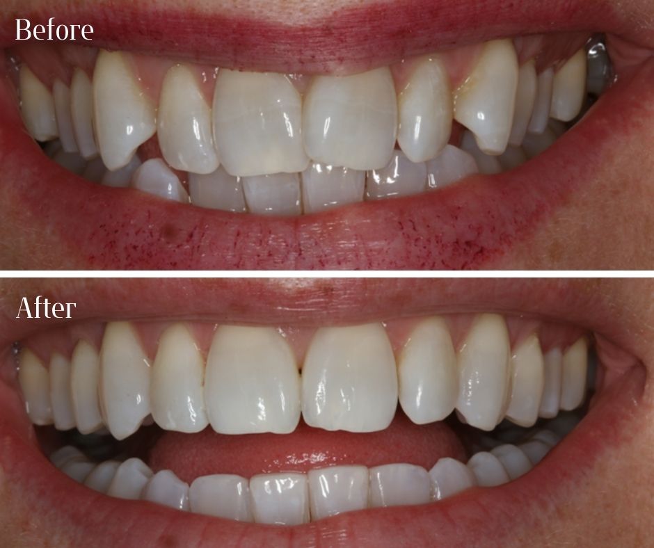 Patient Gallery - 740 Dental