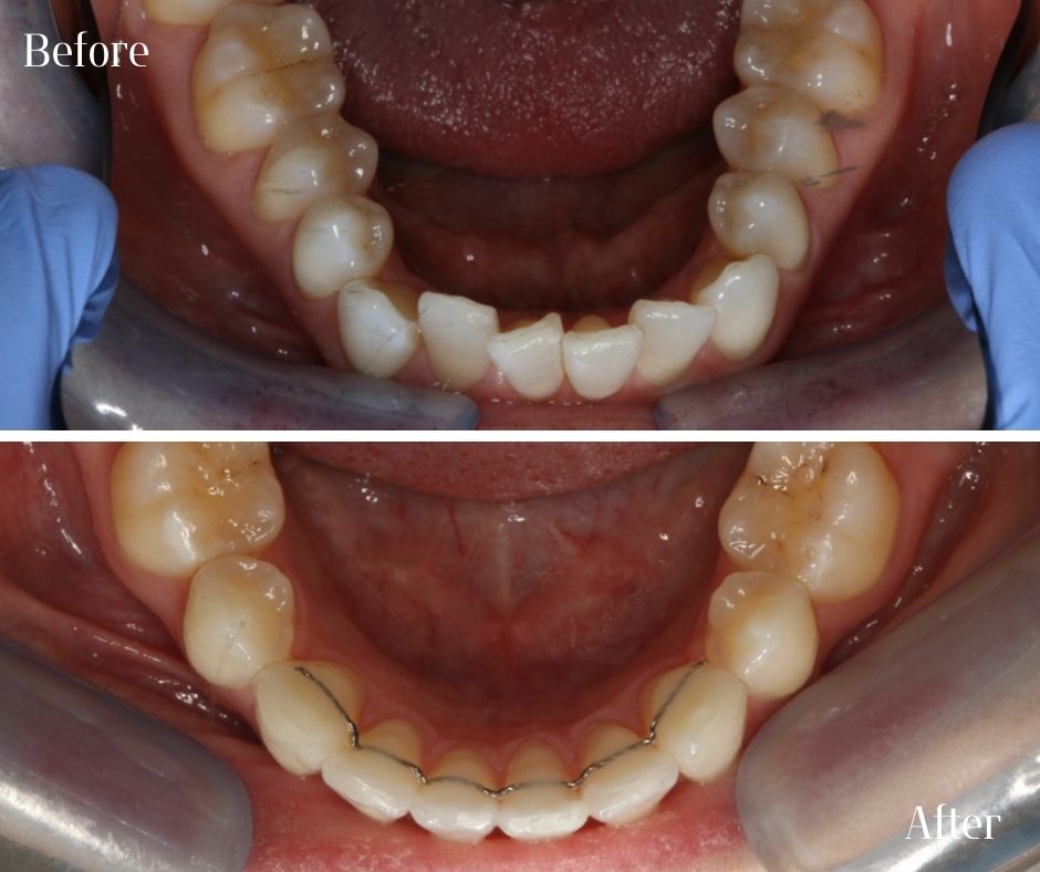 Patient Gallery - 740 Dental