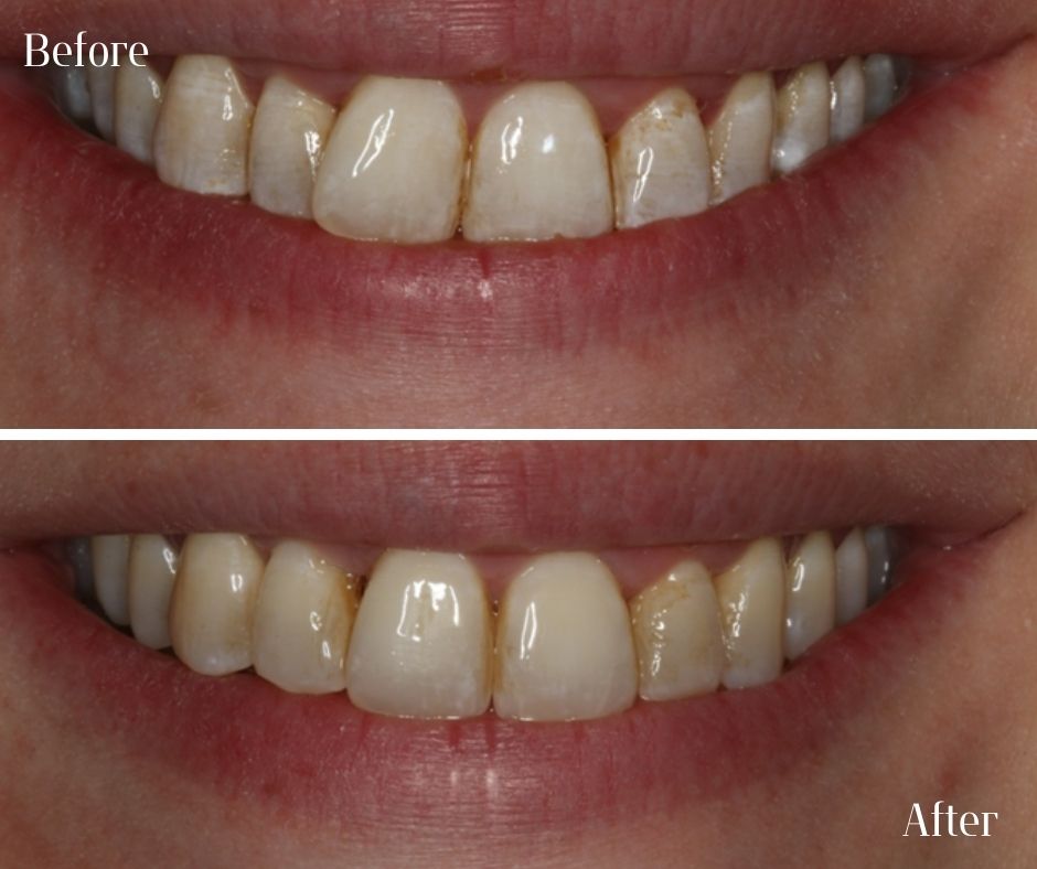 Patient Gallery - 740 Dental
