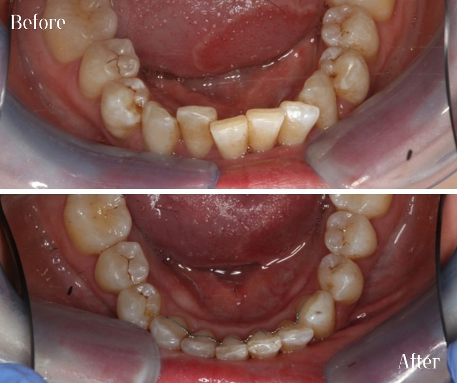 Patient Gallery - 740 Dental