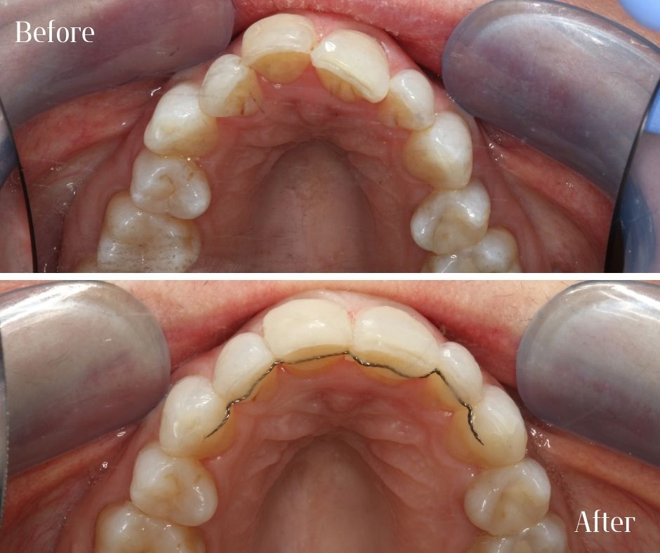 Patient Gallery - 740 Dental