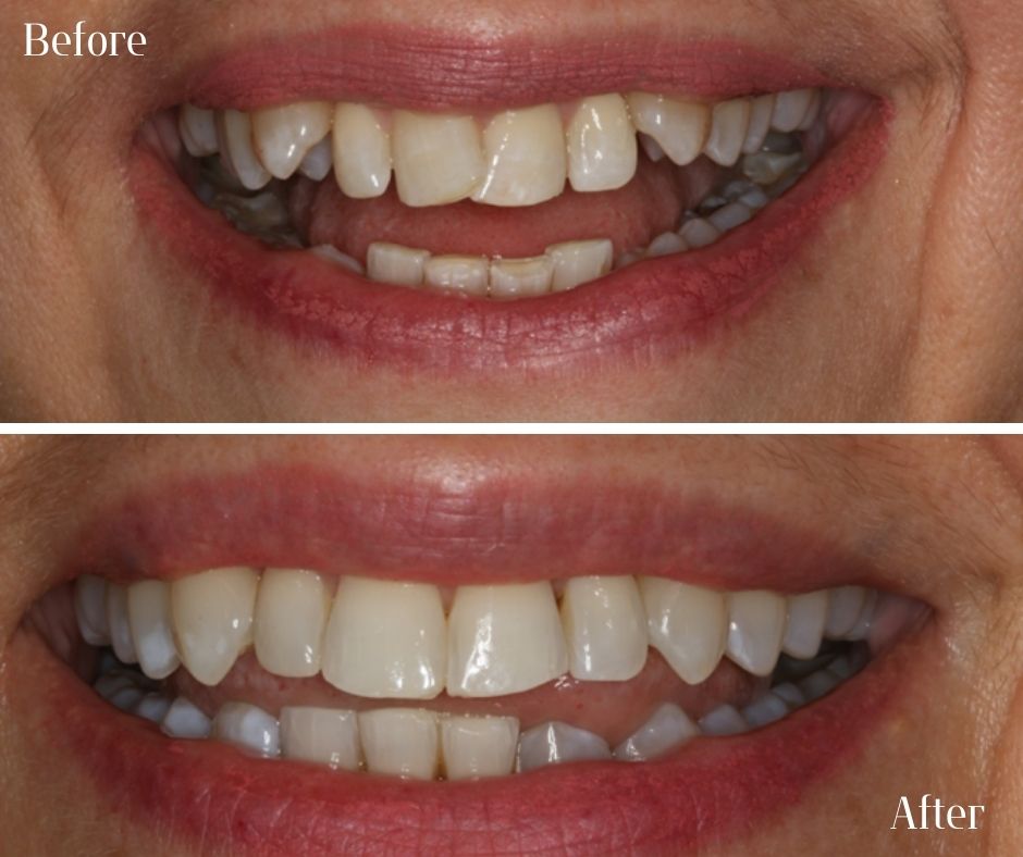 Patient Gallery - 740 Dental