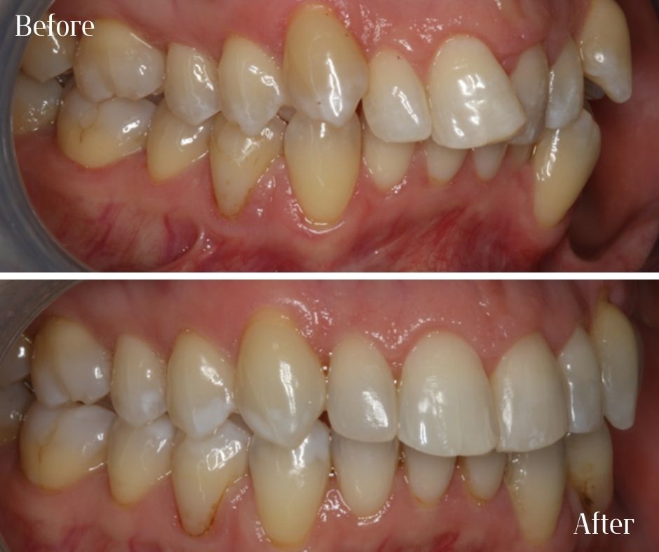 Patient Gallery - 740 Dental