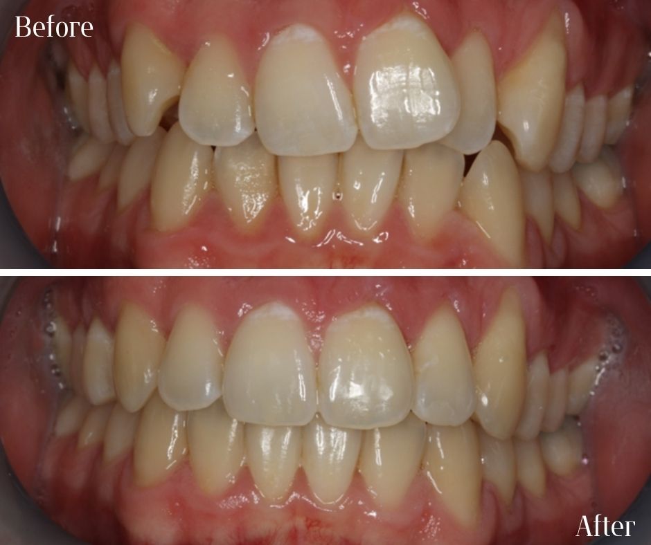 Patient Gallery - 740 Dental