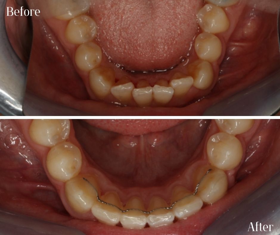 Patient Gallery - 740 Dental