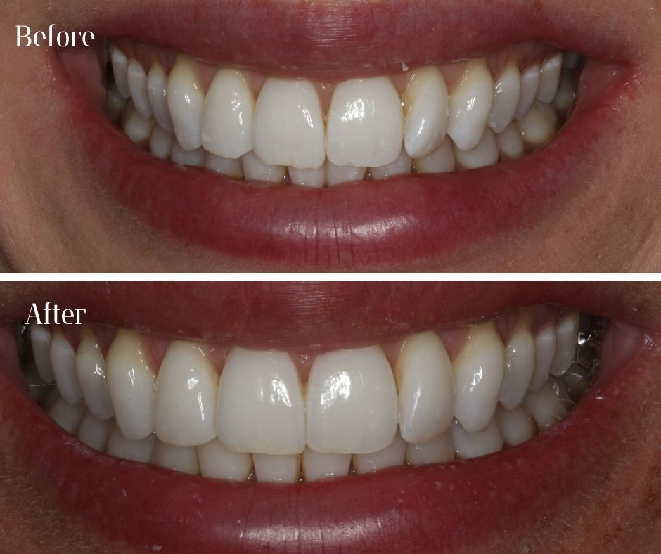 Patient Gallery - 740 Dental