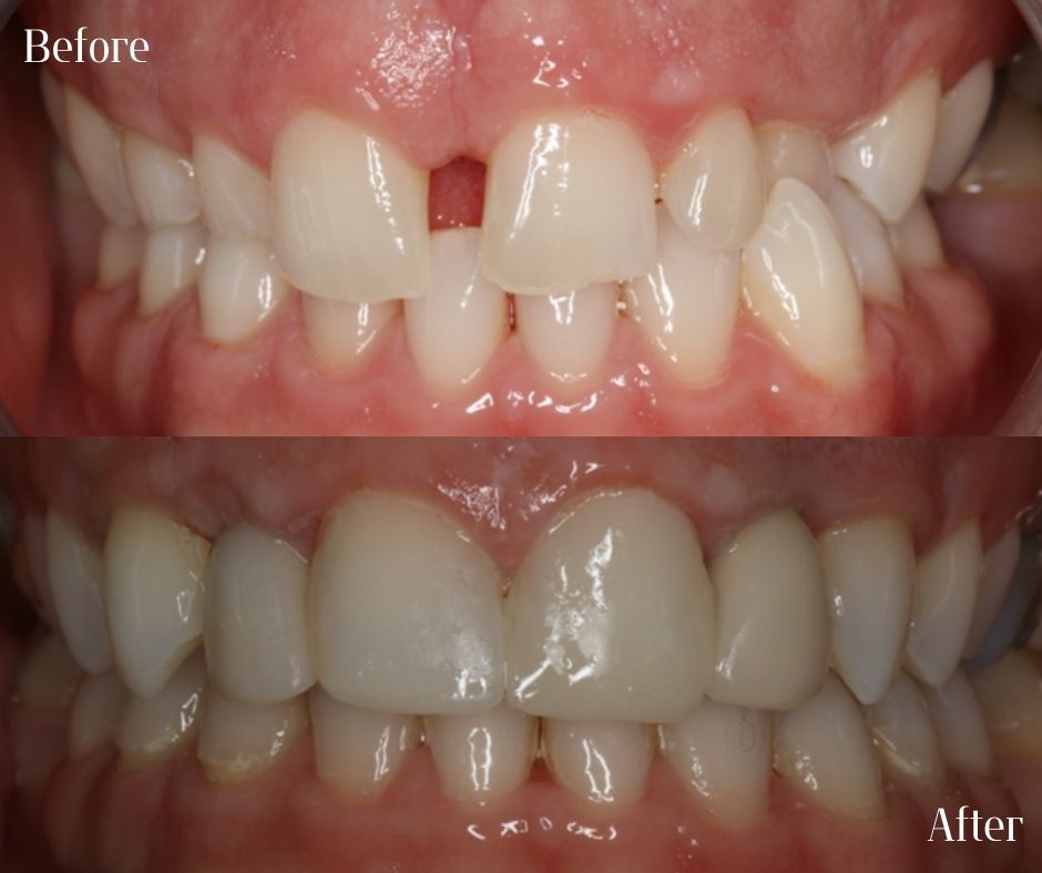 Patient Gallery - 740 Dental