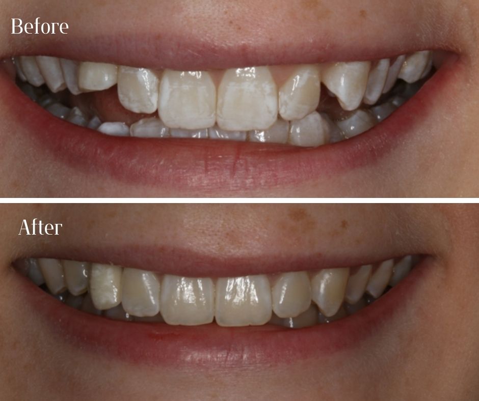 Patient Gallery - 740 Dental