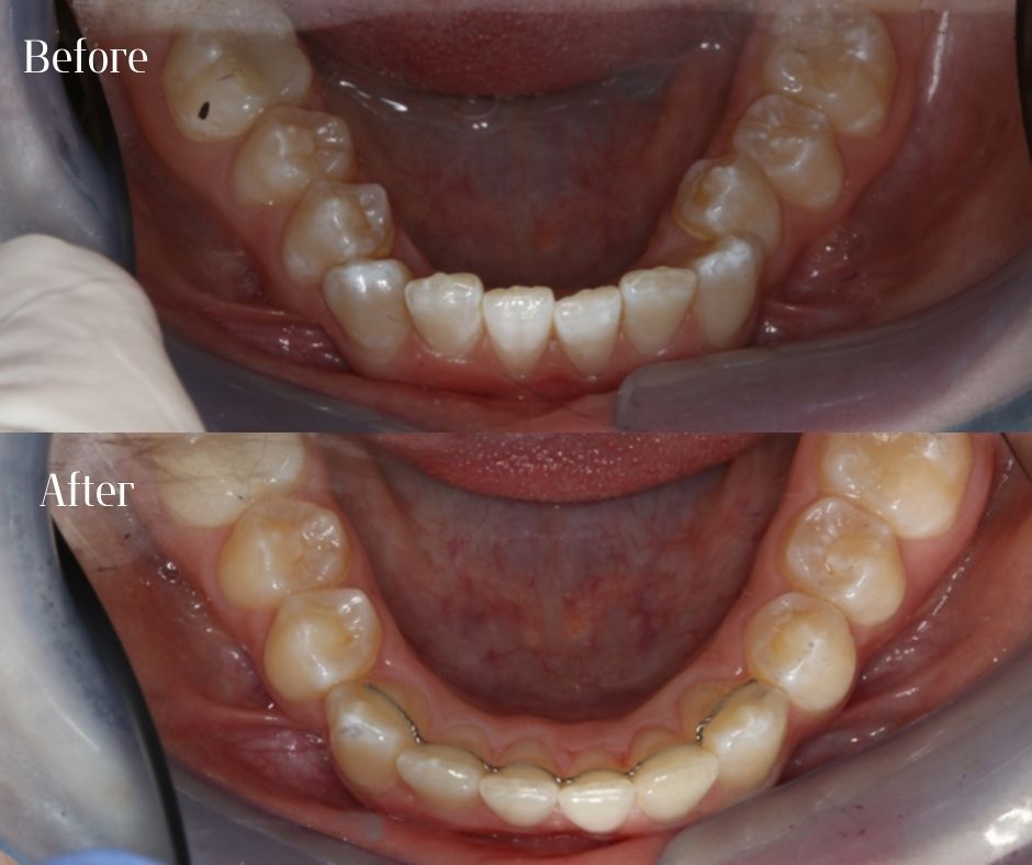 Patient Gallery - 740 Dental