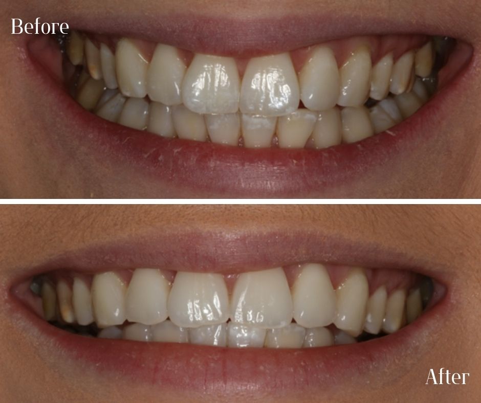 Patient Gallery - 740 Dental