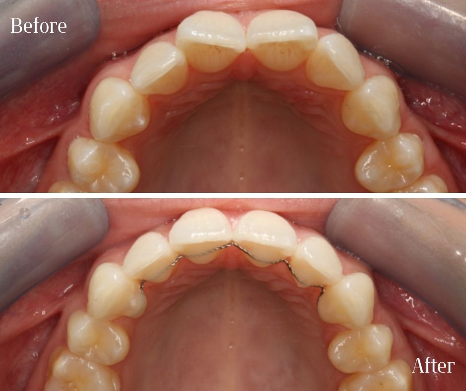 Patient Gallery - 740 Dental