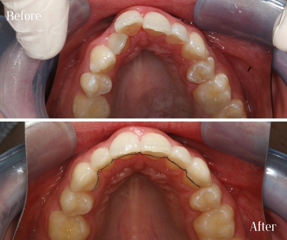 Patient Gallery - 740 Dental