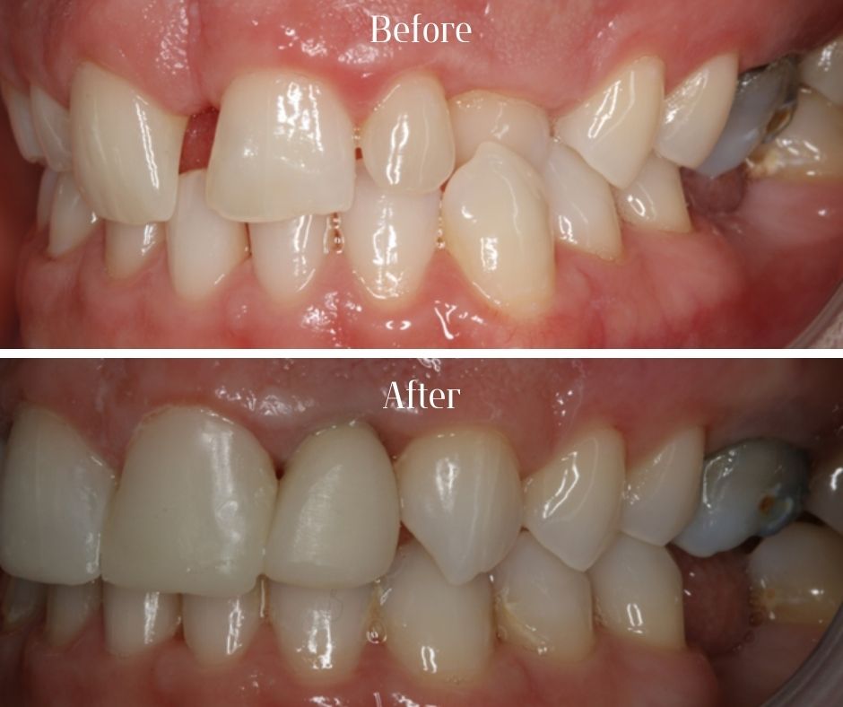 Patient Gallery - 740 Dental