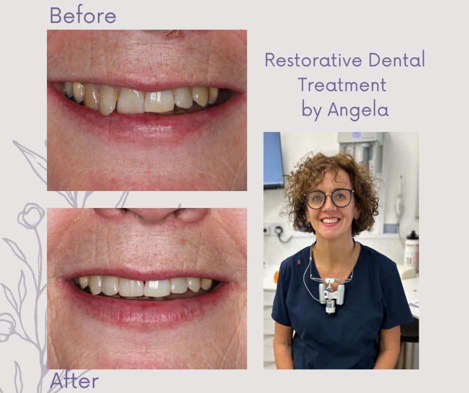 Patient Gallery - 740 Dental