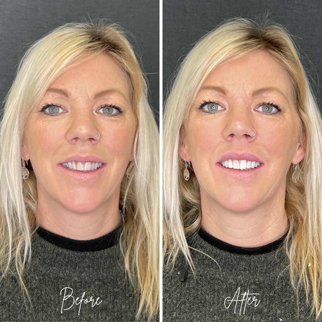 same day smiles at 740 dental