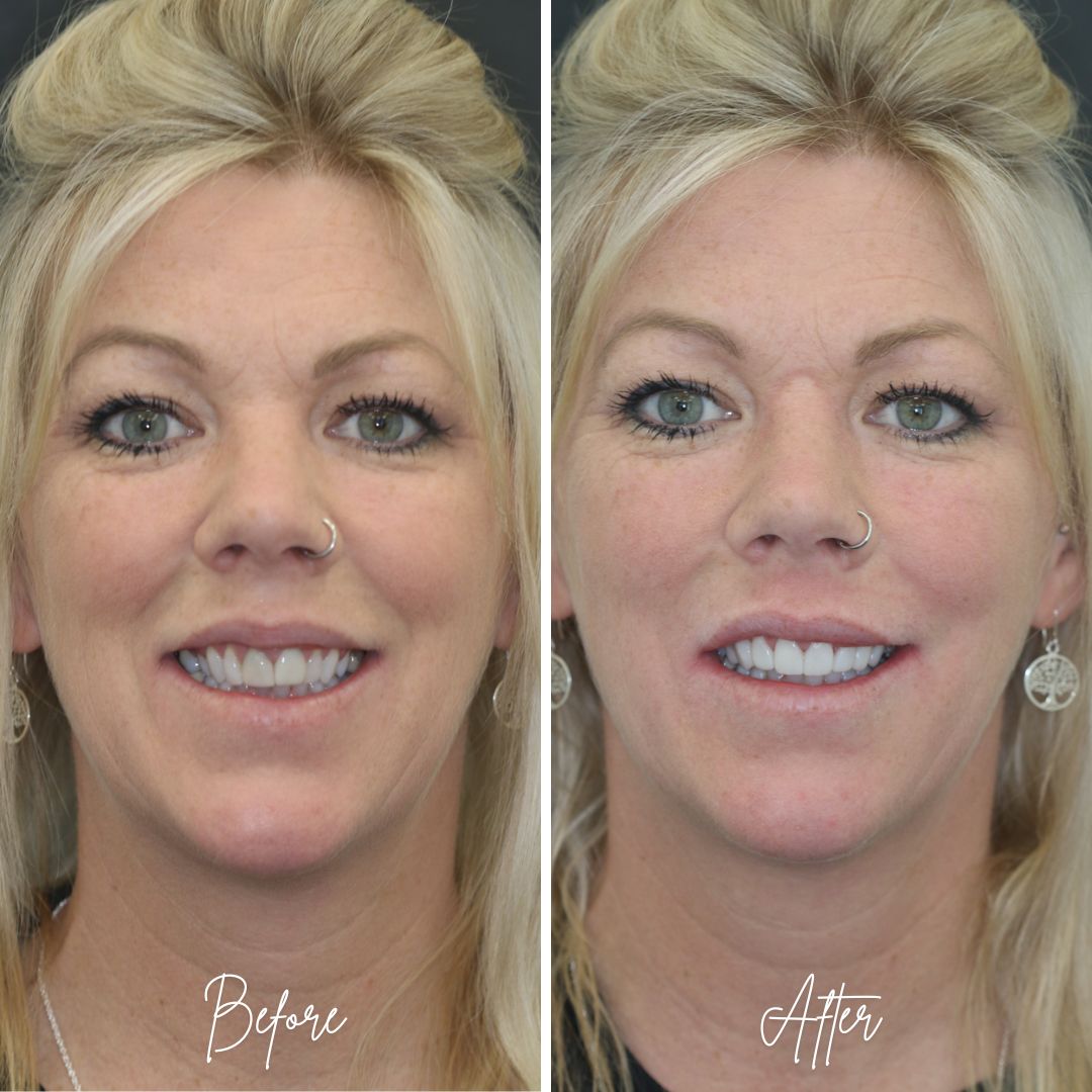 740 treatment packages
