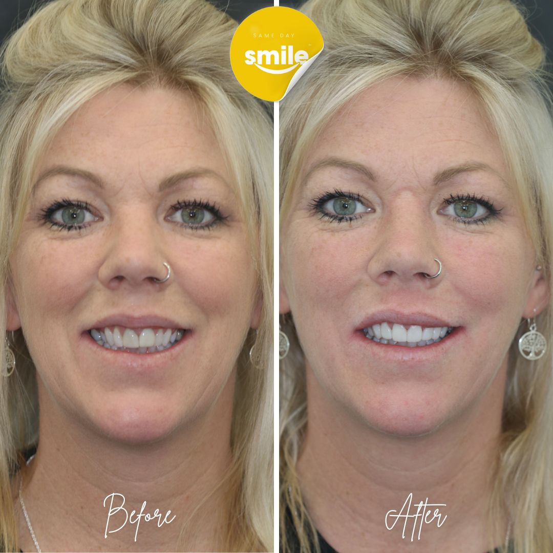 740 Dental In Conjunction With Same Day Smiles