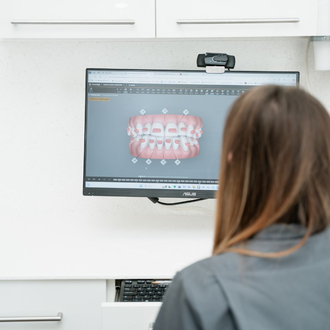 Straight Teeth Braces - 740 Dental