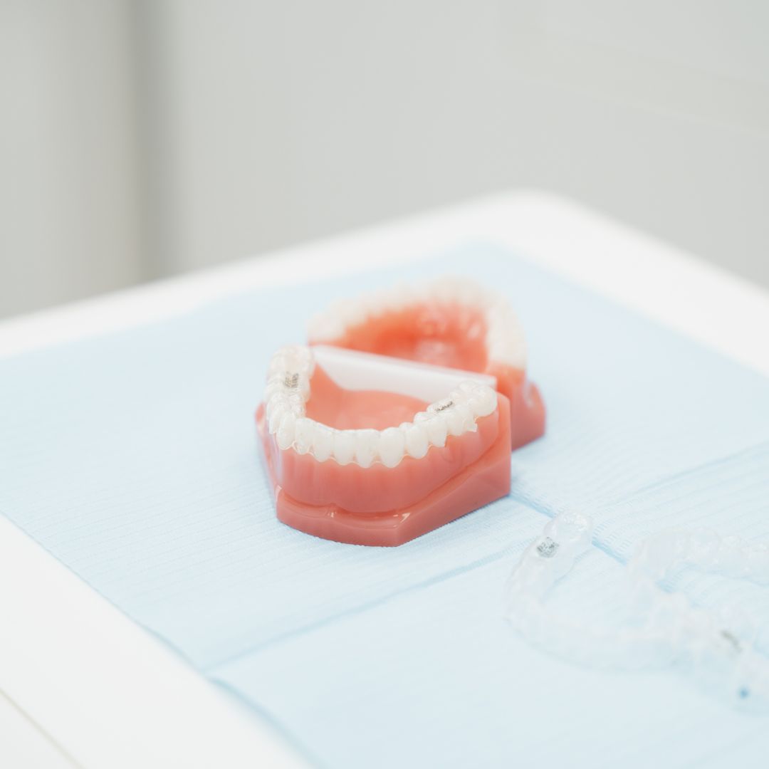 Teeth Whitening - 740 Dental