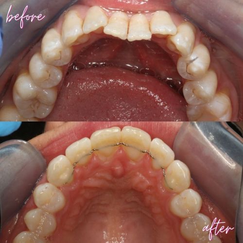Cosmetic Dentistry - 740 Dental Cosmetic Dentistry - 740 Dental