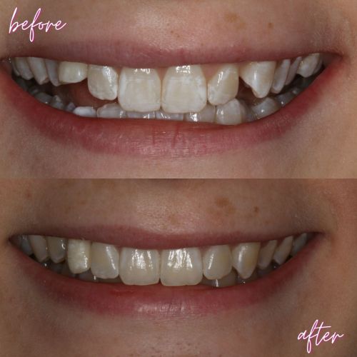 Cosmetic Dentistry - 740 Dental